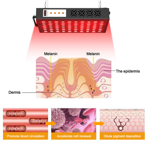 Does Red Light Therapy Help Acne?
